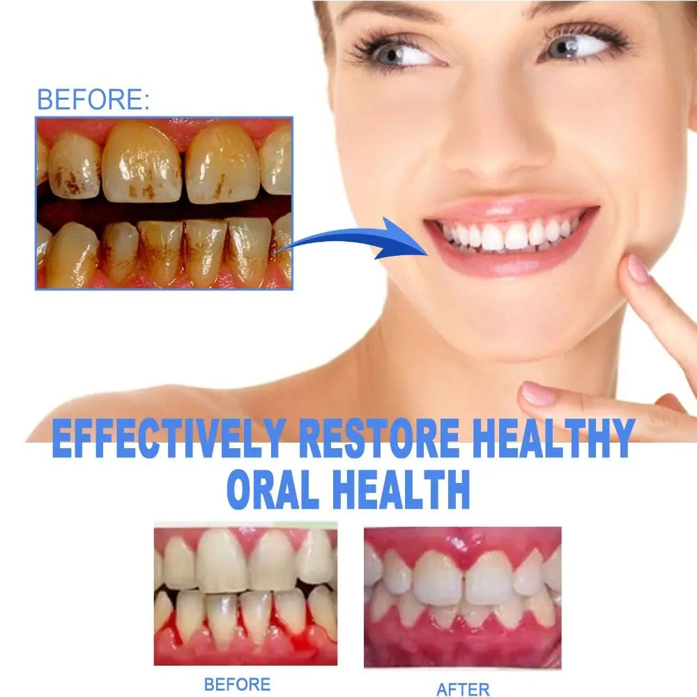 Dental Repair Gum Treatment Gel Reduces Discomfort Reduces Inflammation Gum Shield Therapy Gel Easy to Use Oral Care